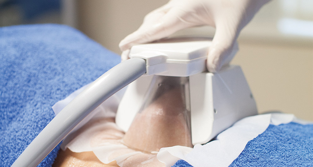 How Fat Freezing and HIFU Work Together? 2 Multiple Areas in One Session HIFU and Fat Freezing Burgess Hill