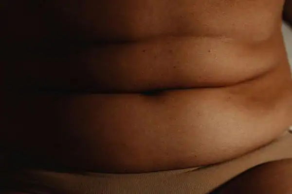 The Hidden Connection: How Stress Shapes Your Fitness and Body Composition 3 image of what stress can do on the stomach area and how Lipo 360 Burgess Hill can help to change your body shape.